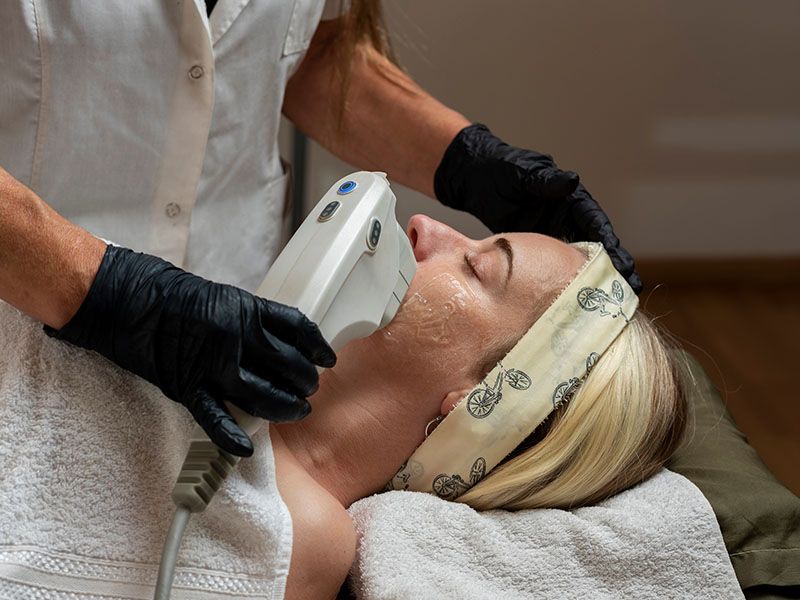 Photo showing a facial HIFU Treatment